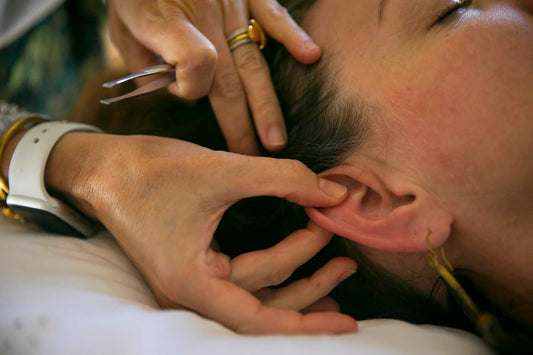 Image of ear seeds being applied in auricular therapy.